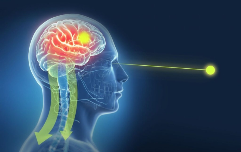 brainspotting